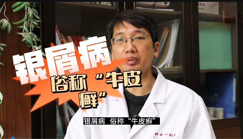 四招治療銀屑病 俗稱“牛皮癬”